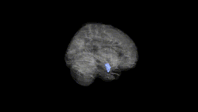 Full Brain Black
