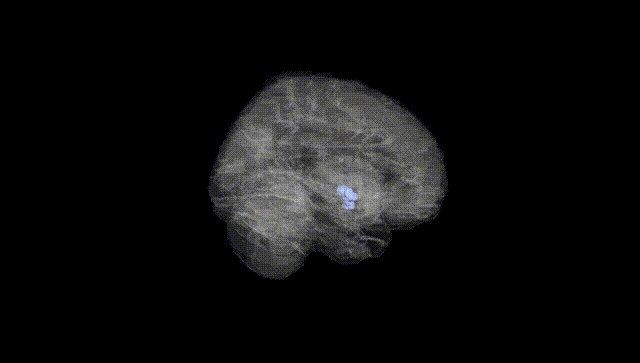 Full Brain Black