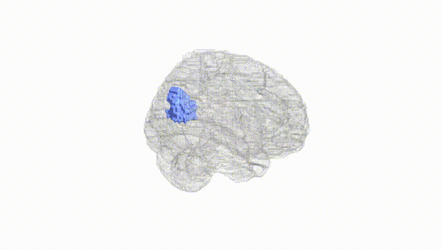 Full Brain White