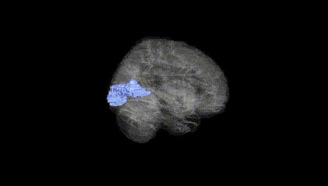 Full Brain Black