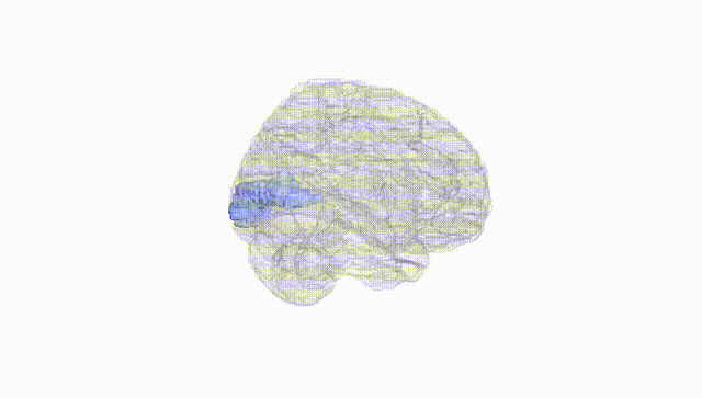 Full Brain White