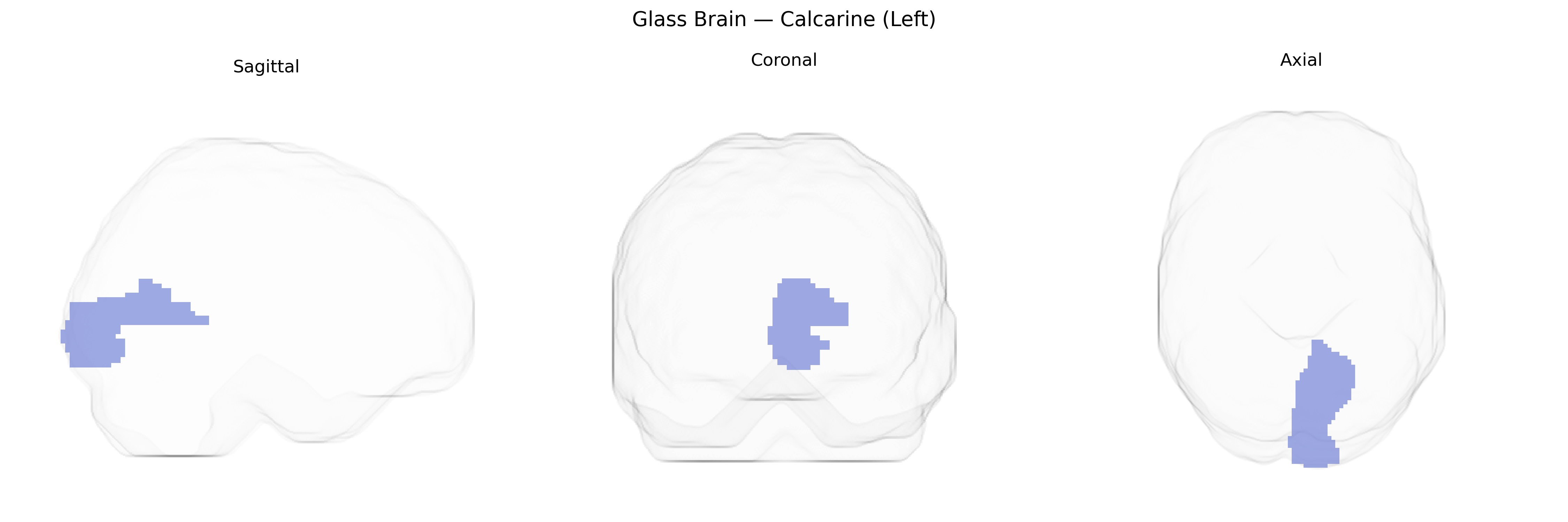 Triplanar Ghost Brain