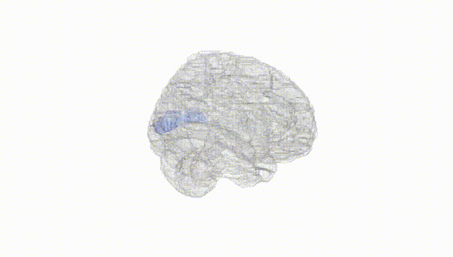 Full Brain White