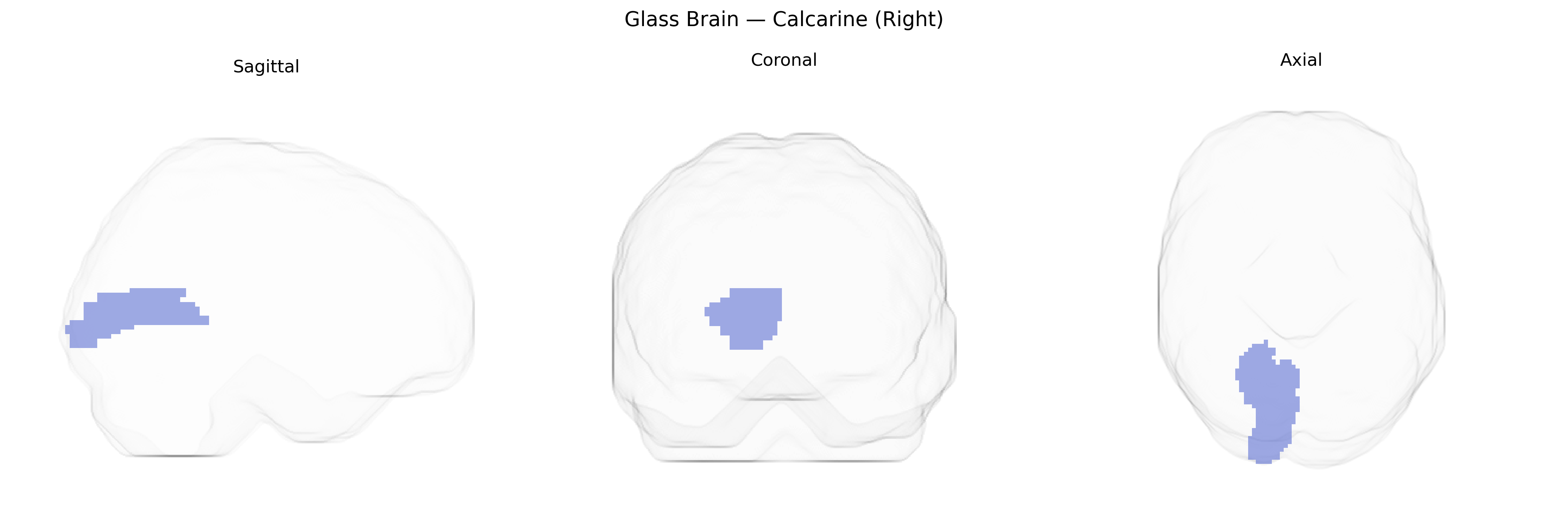 Triplanar Ghost Brain