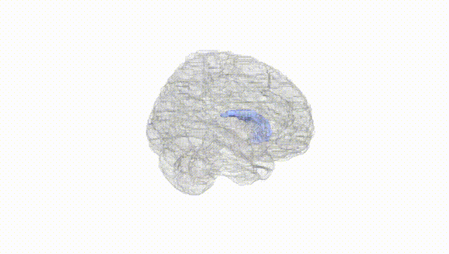 Full Brain White