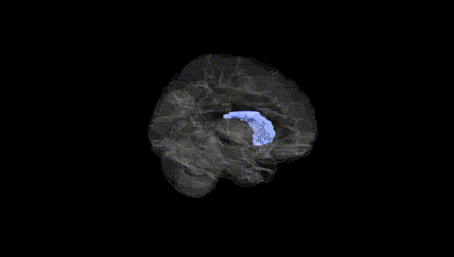 Hemisphere Black