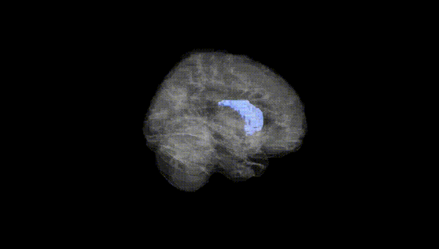 Full Brain Black