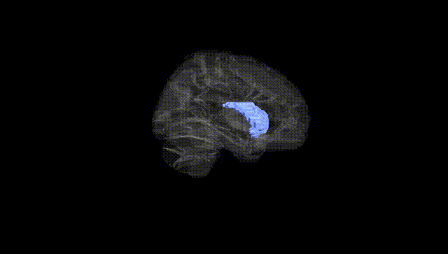 Hemisphere Black