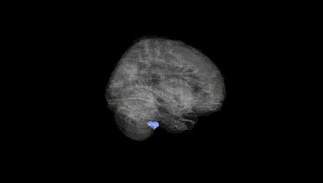 Full Brain Black