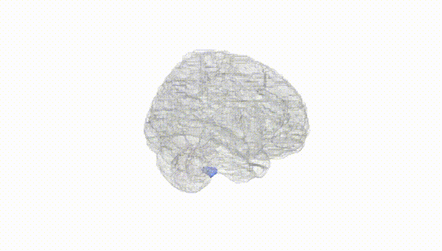 Full Brain White
