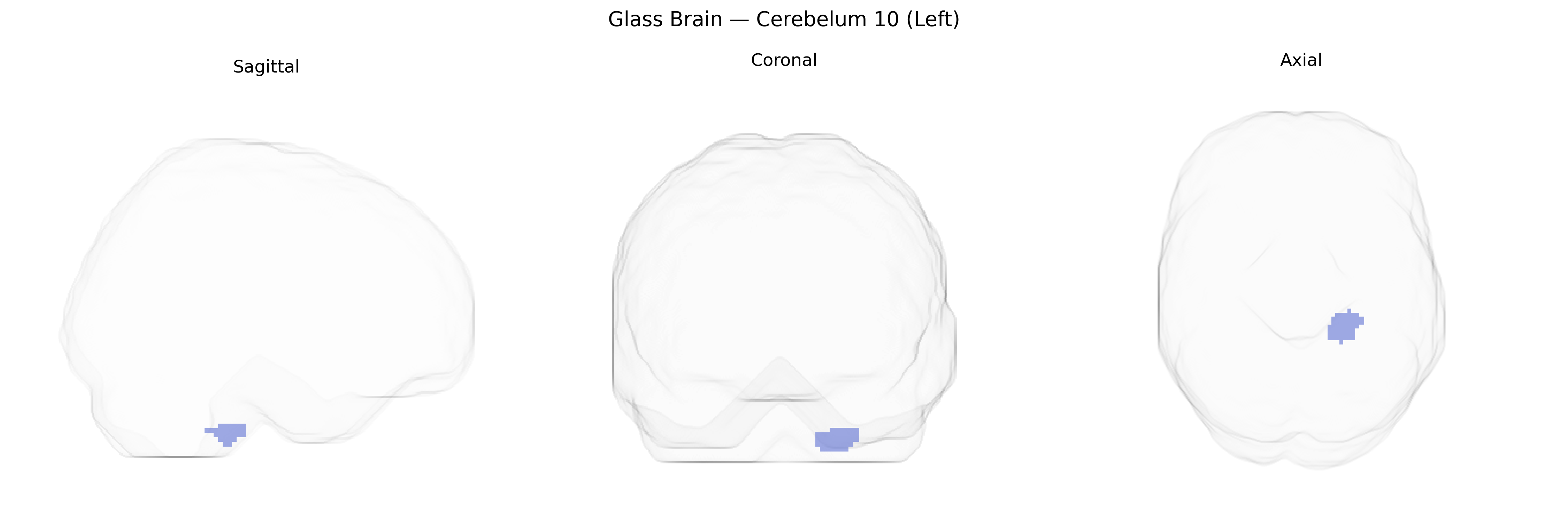 Triplanar Ghost Brain