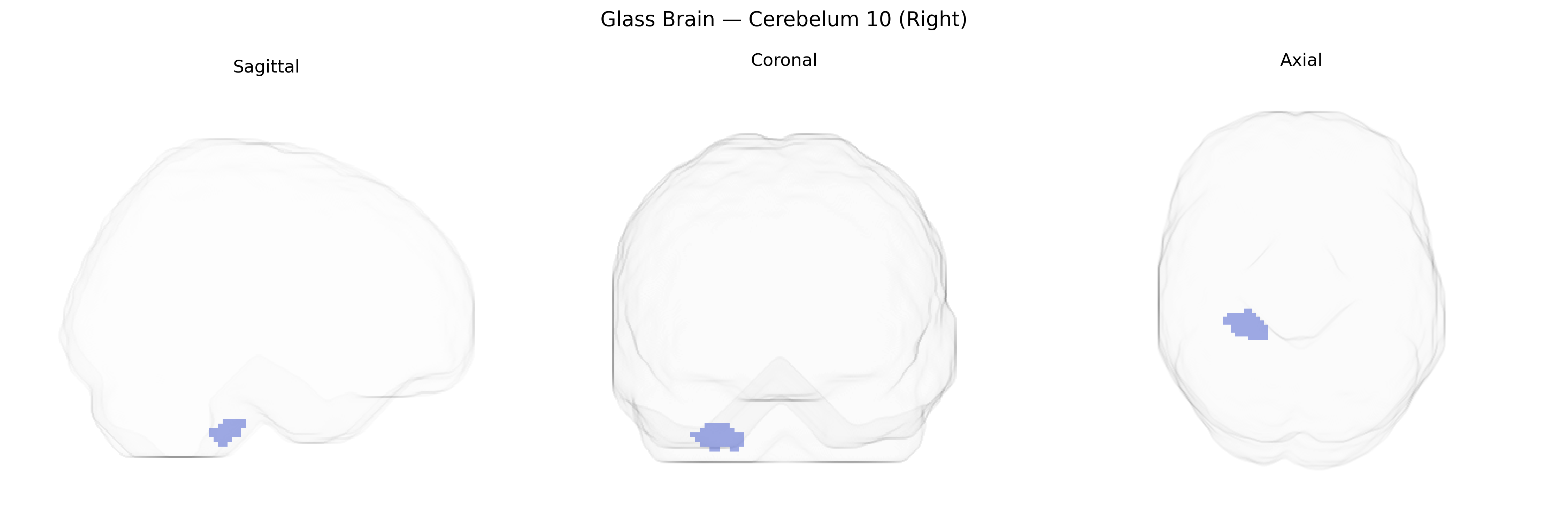 Triplanar Ghost Brain