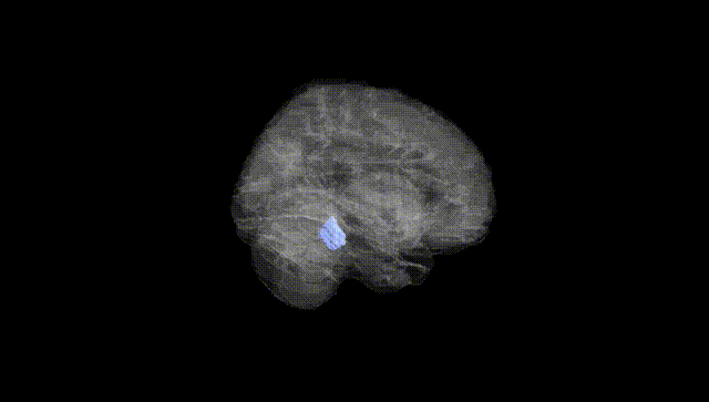 Full Brain Black