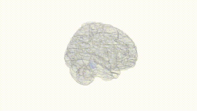 Full Brain White