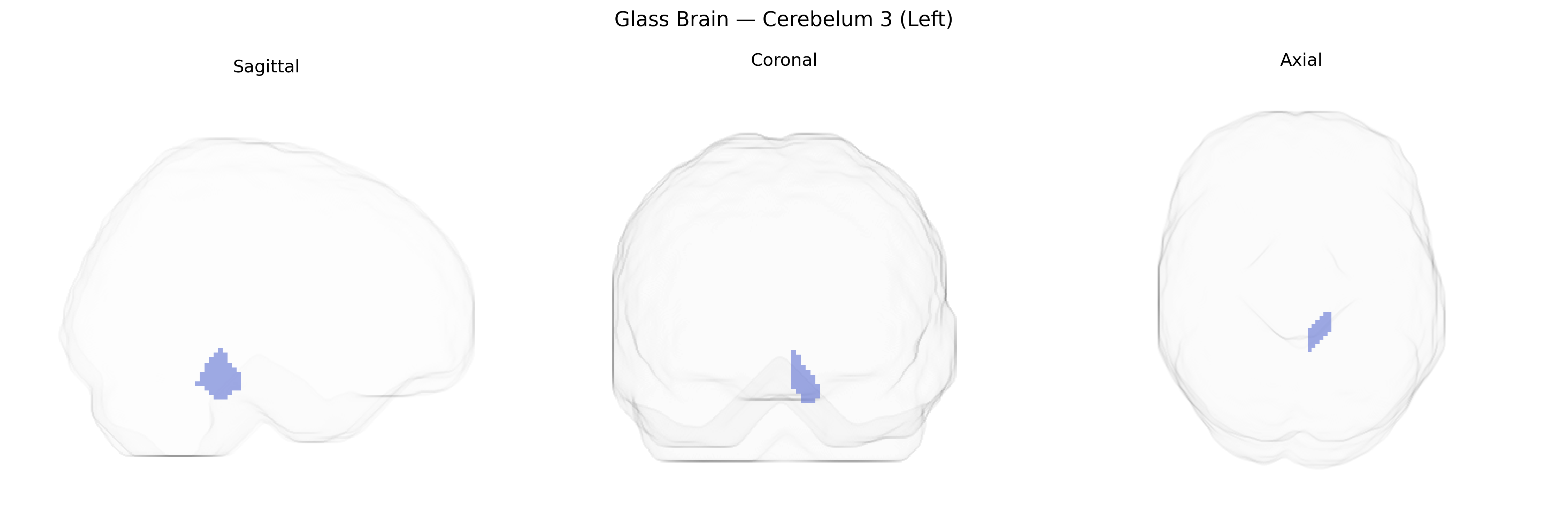 Triplanar Ghost Brain