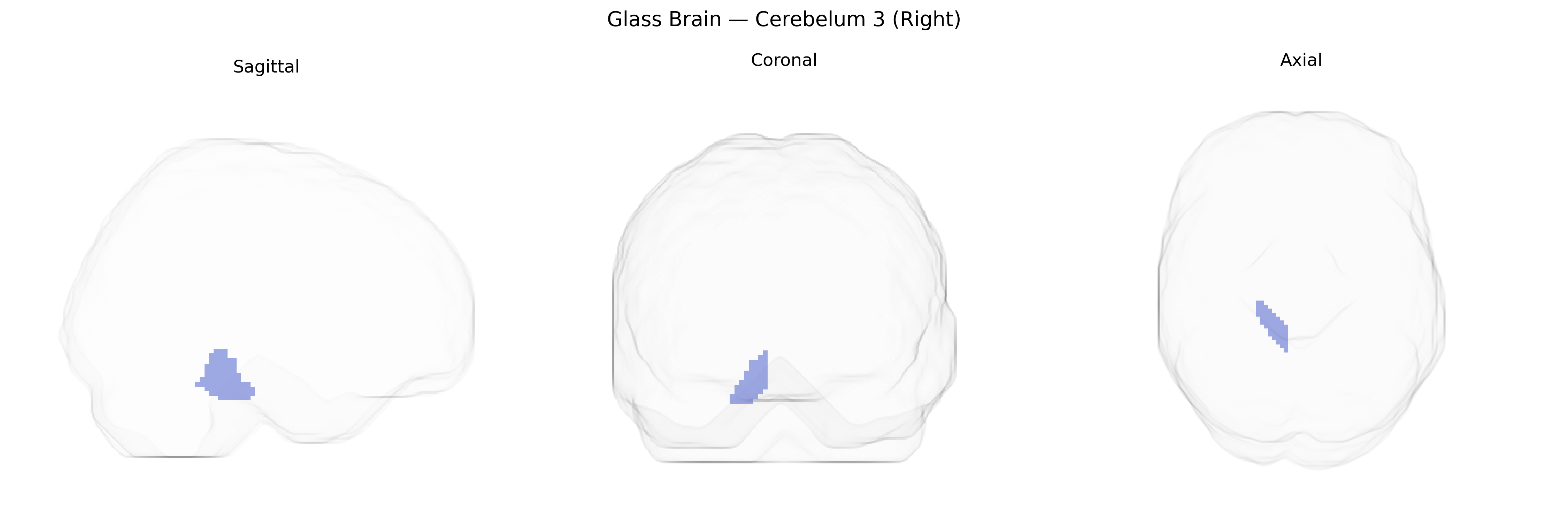 Triplanar Ghost Brain