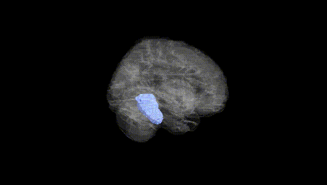 Full Brain Black