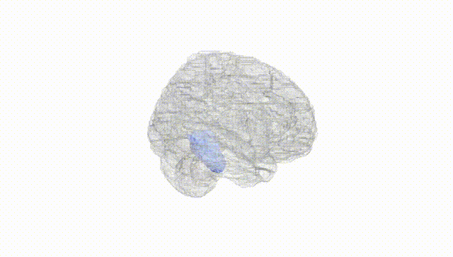 Full Brain White
