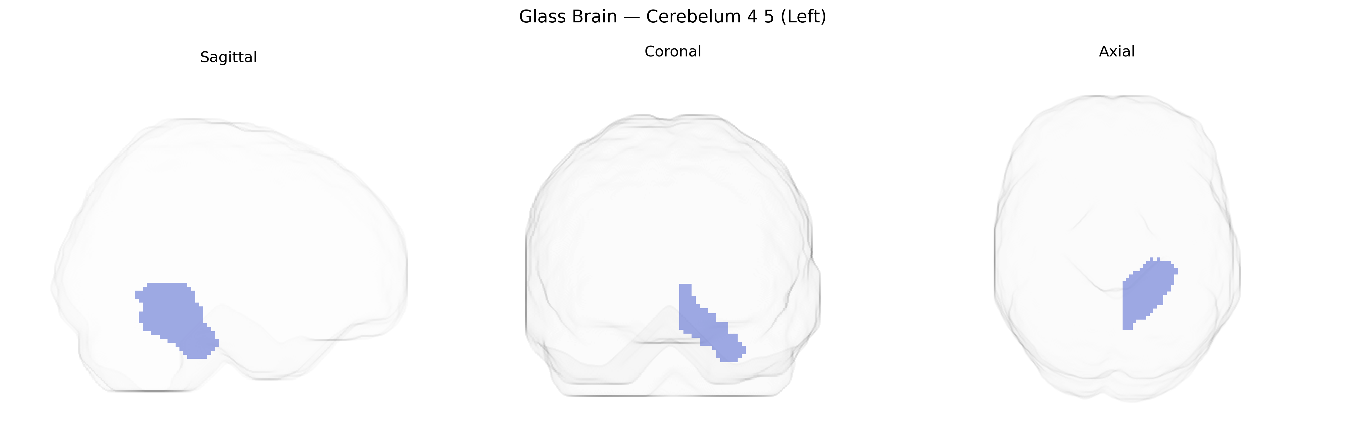 Triplanar Ghost Brain