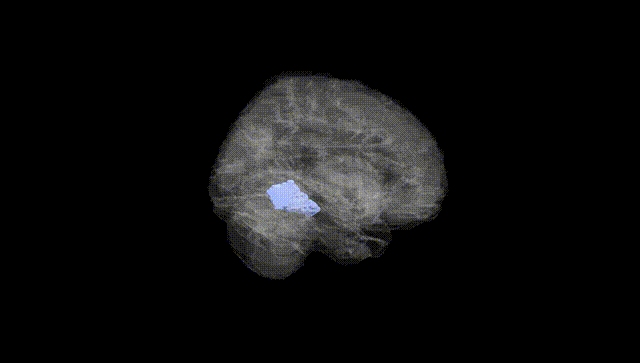 Full Brain Black