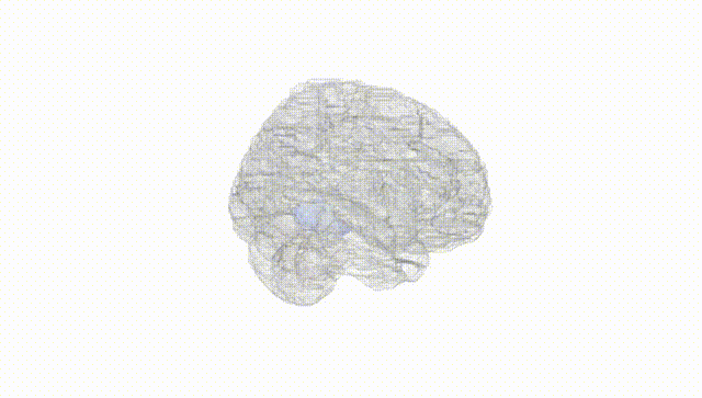 Full Brain White