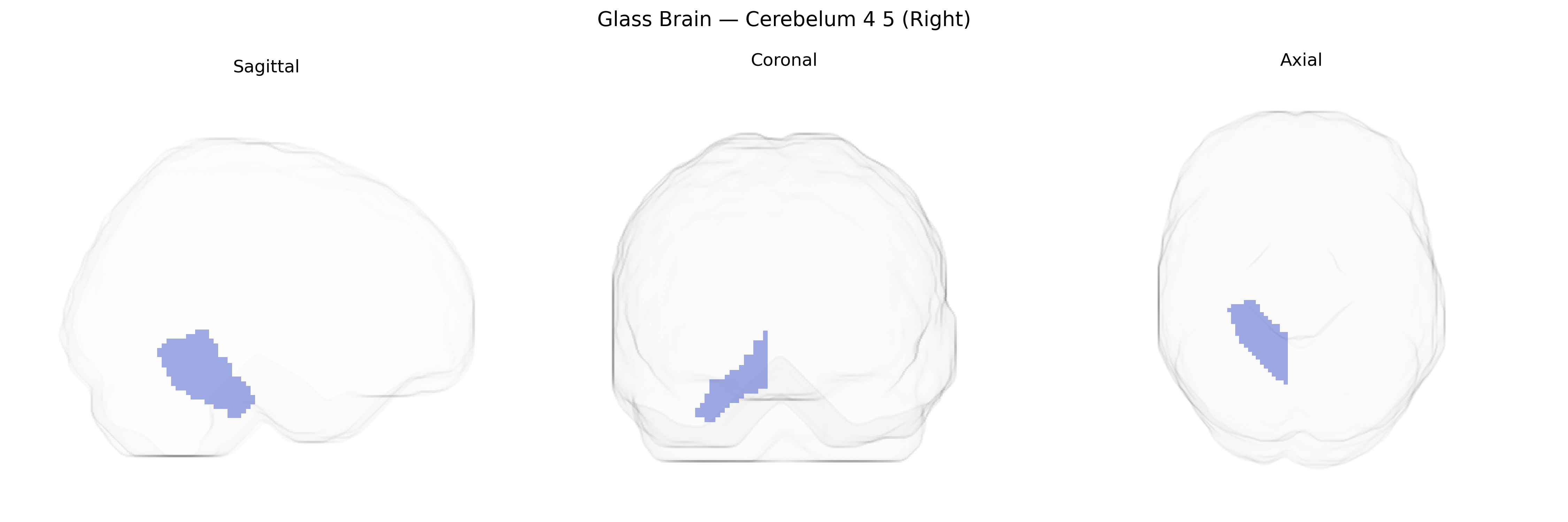 Triplanar Ghost Brain