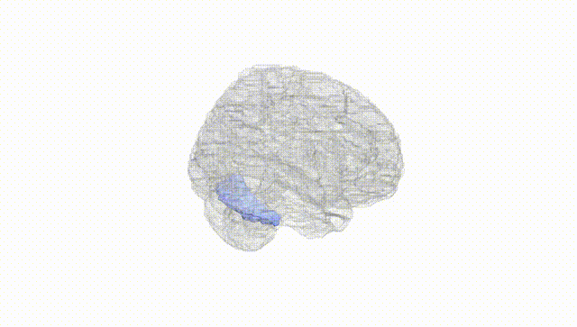 Full Brain White