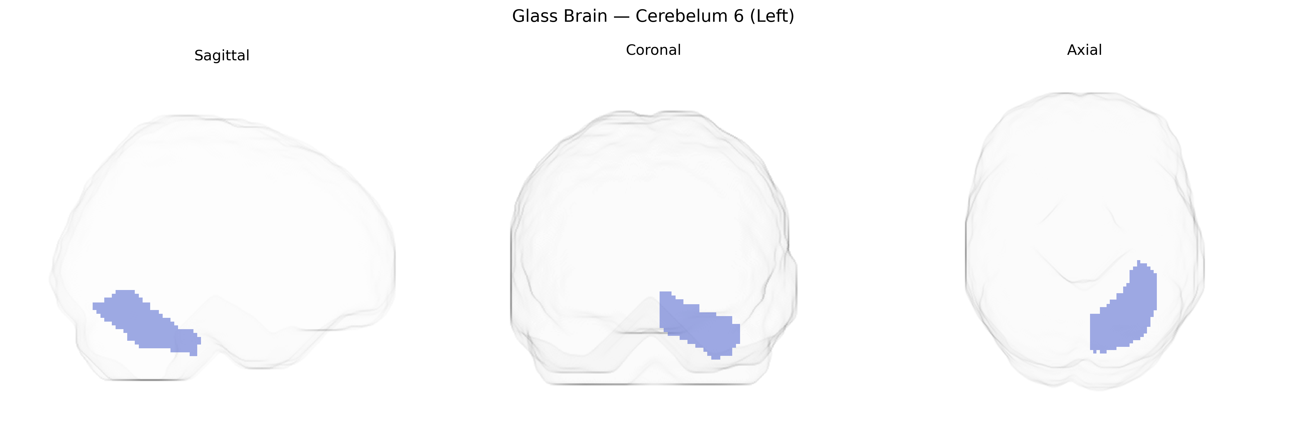 Triplanar Ghost Brain