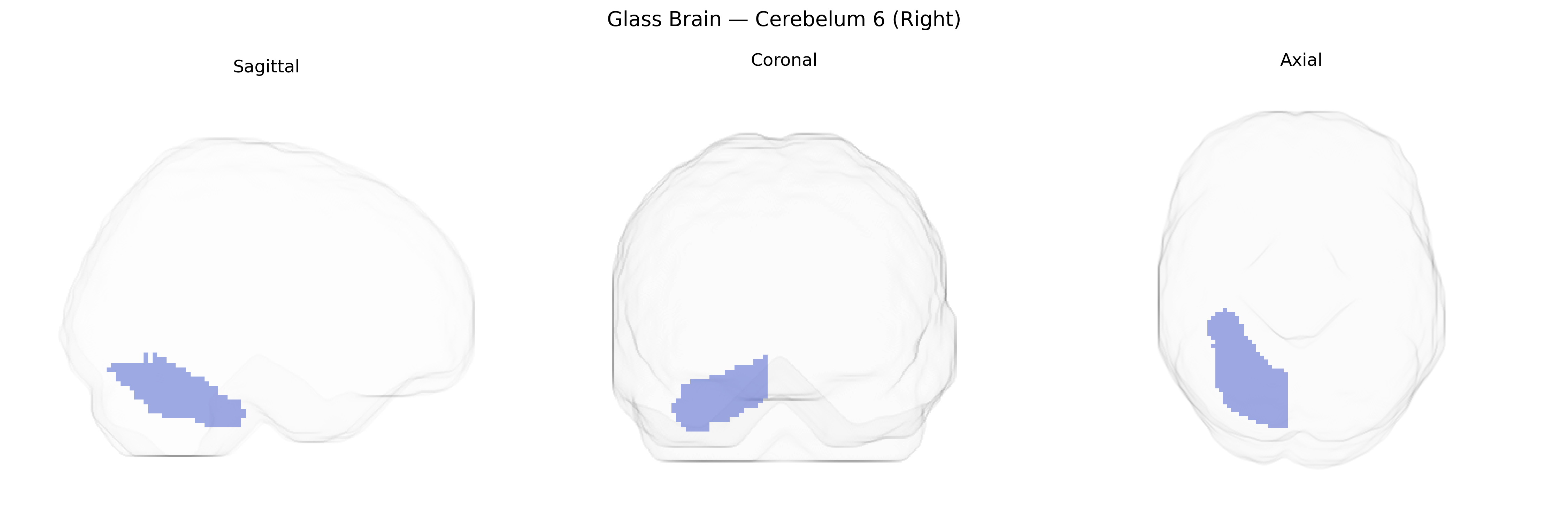Triplanar Ghost Brain