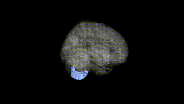 Full Brain Black