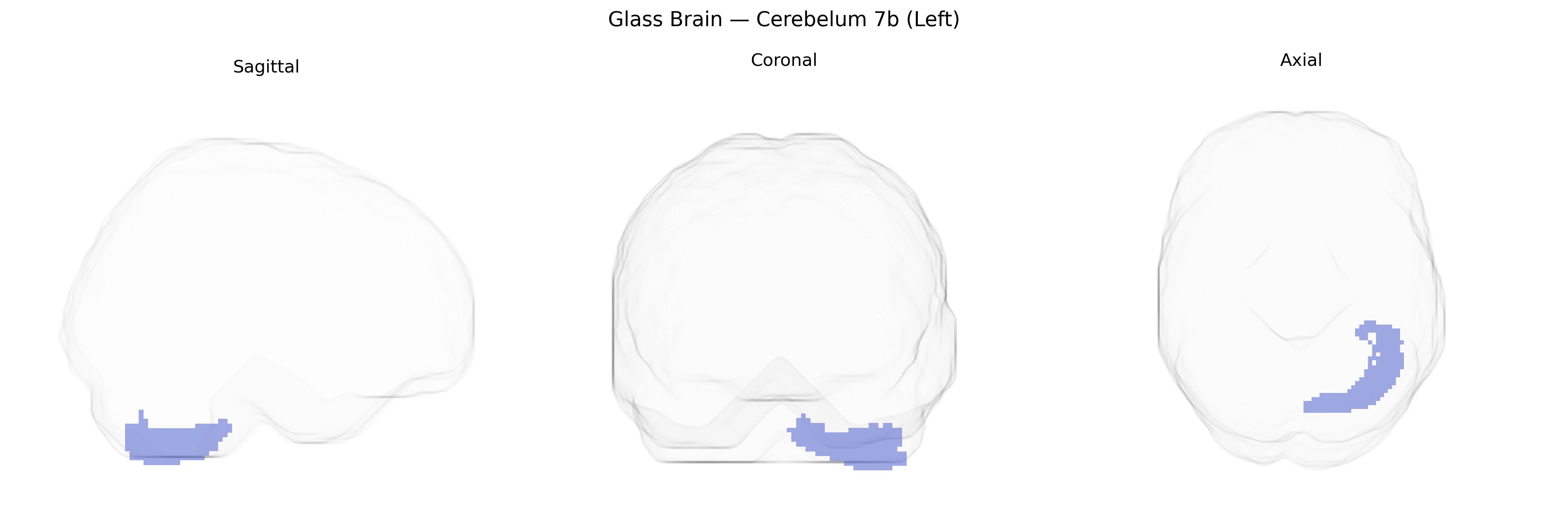 Triplanar Ghost Brain