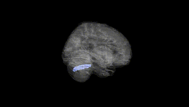 Full Brain Black