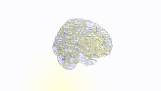 Full Brain White