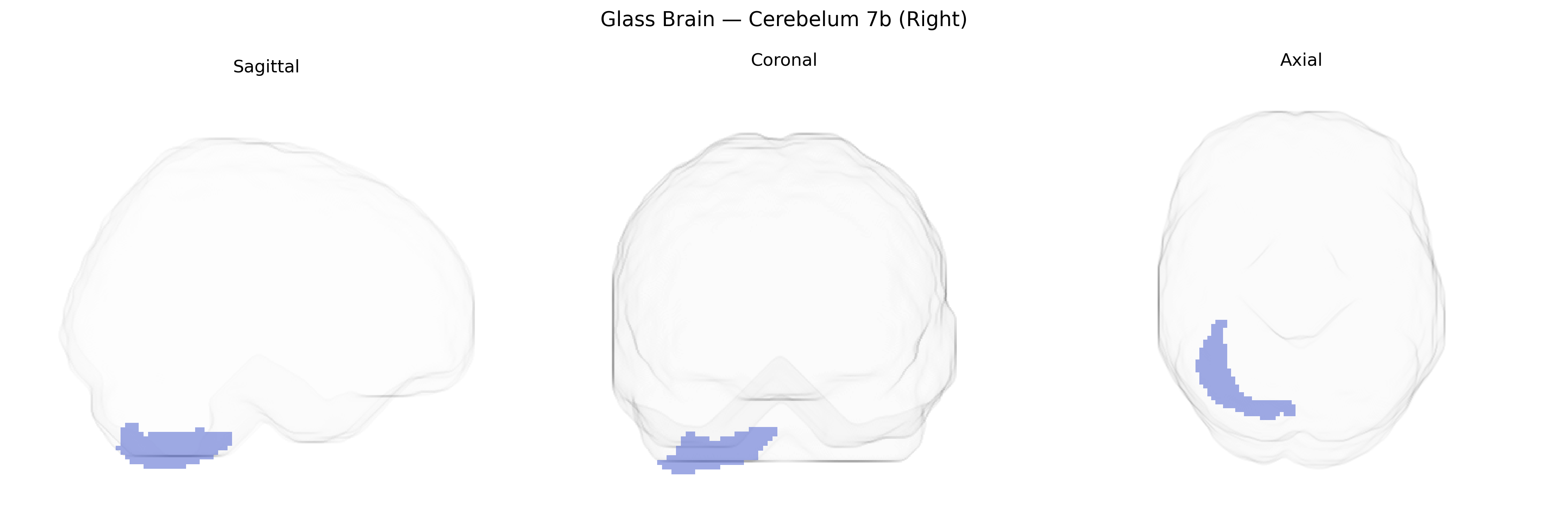 Triplanar Ghost Brain
