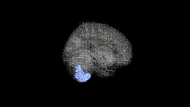 Full Brain Black