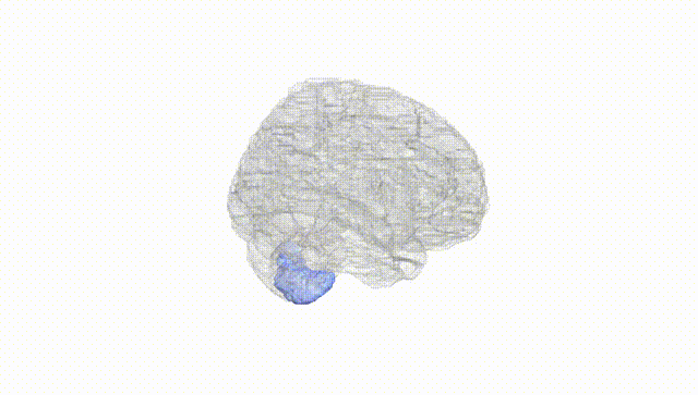 Full Brain White