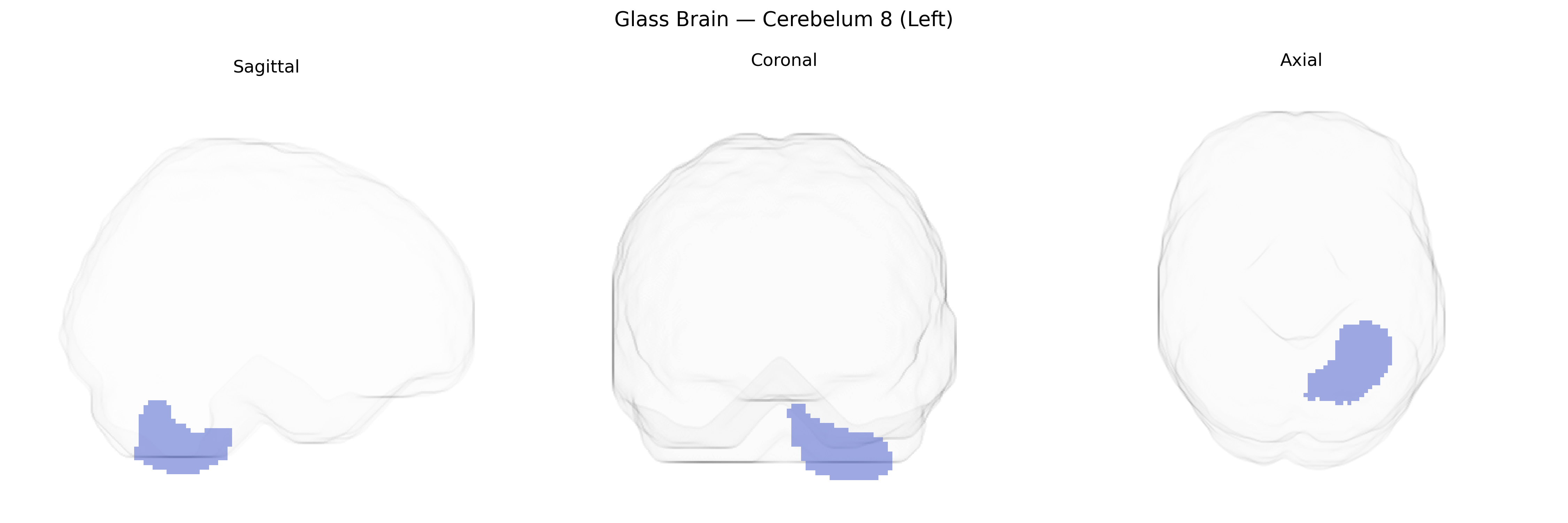 Triplanar Ghost Brain
