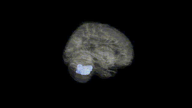 Full Brain Black