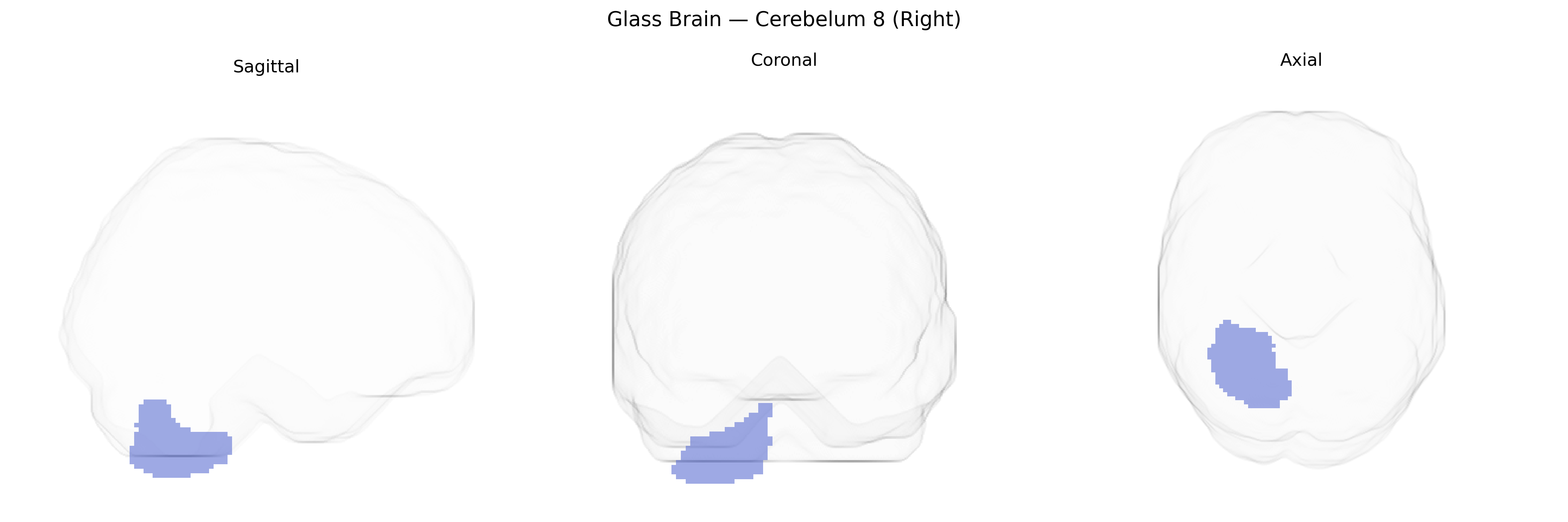 Triplanar Ghost Brain