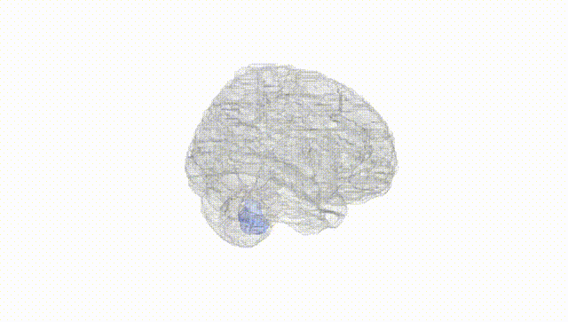 Full Brain White