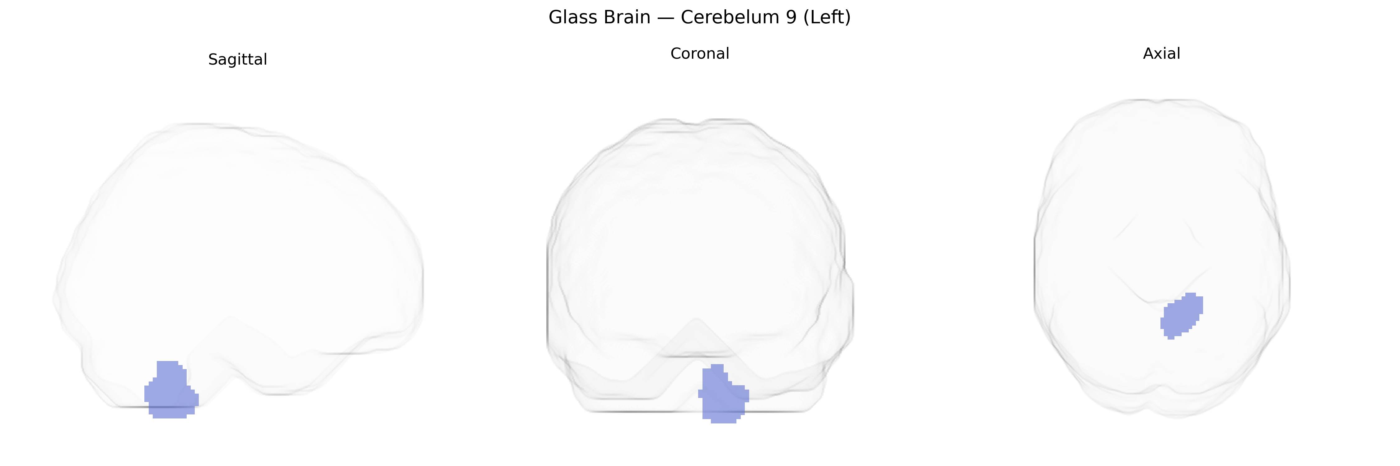 Triplanar Ghost Brain