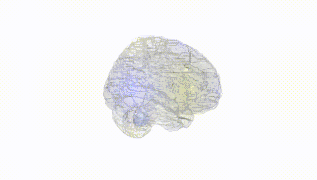 Full Brain White