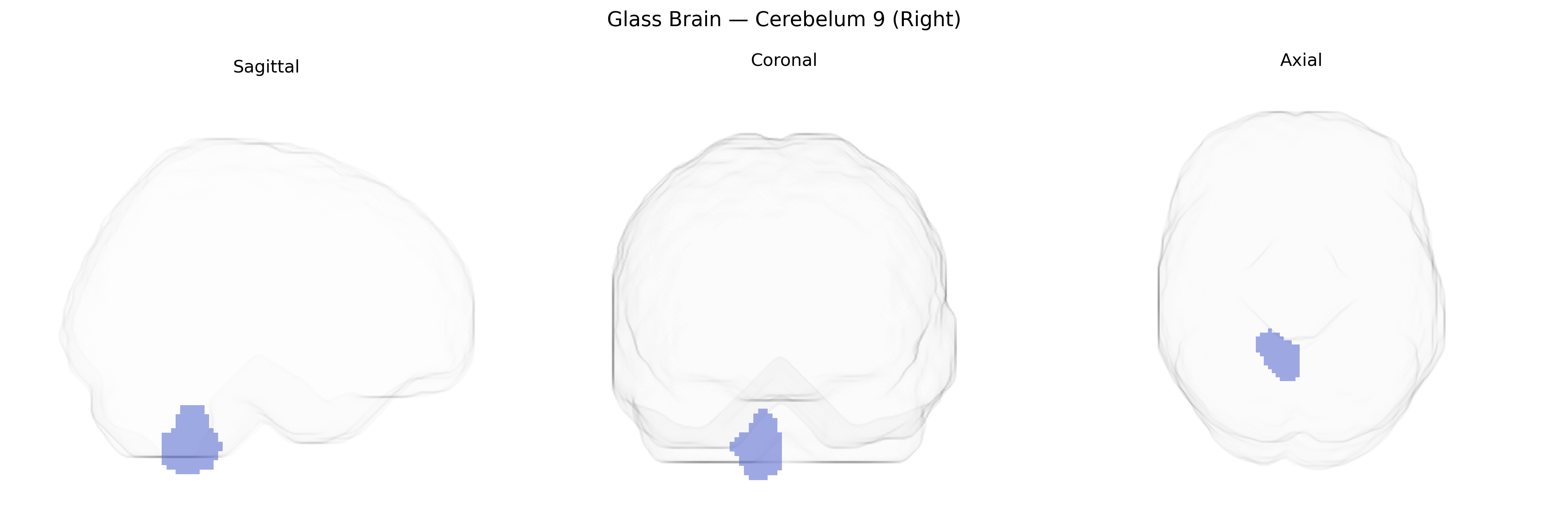 Triplanar Ghost Brain