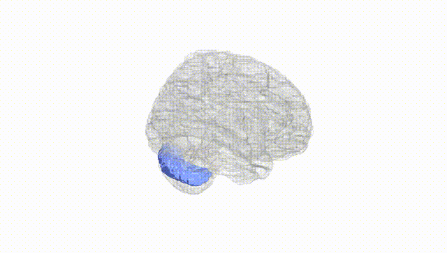 Full Brain White