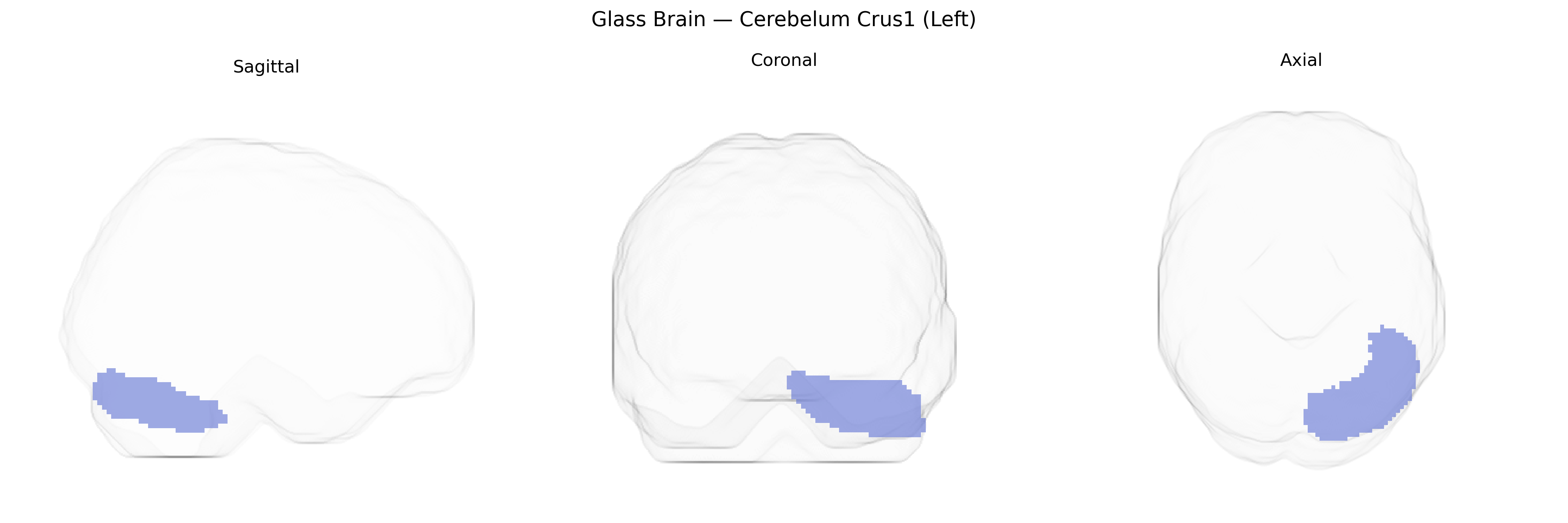 Triplanar Ghost Brain