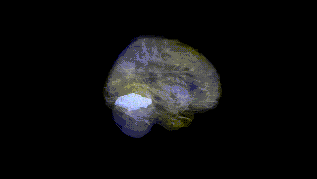 Full Brain Black