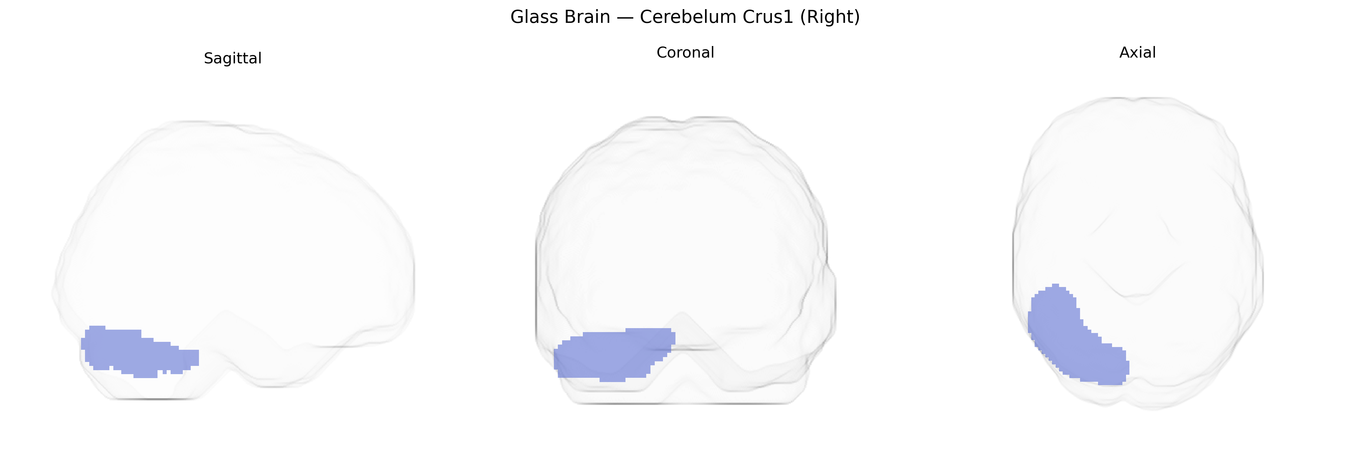 Triplanar Ghost Brain