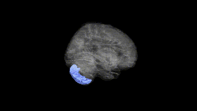 Full Brain Black