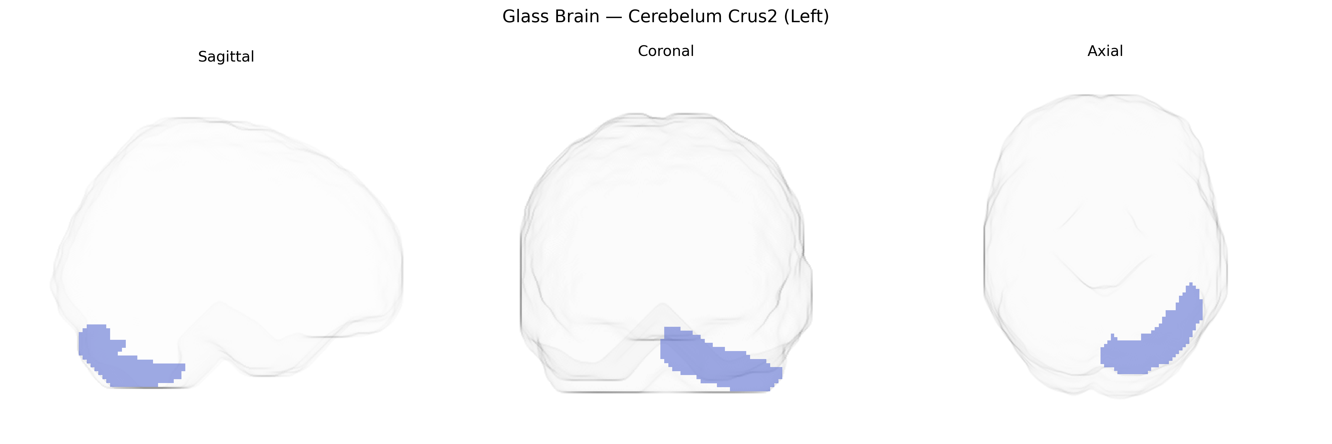 Triplanar Ghost Brain