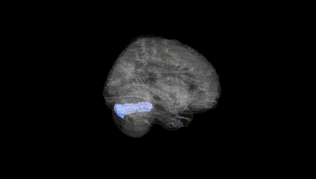 Full Brain Black